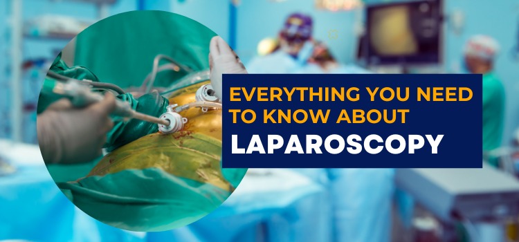 Everything you need to know about laparoscopy