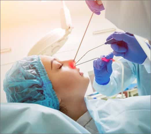 Sinus Endoscopic Surgeon