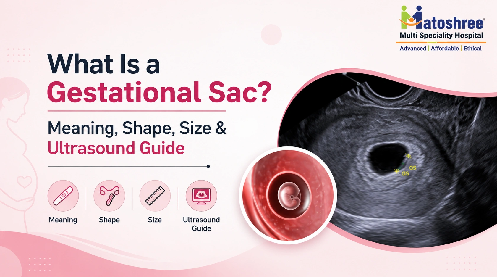 What Is a Gestational Sac? Meaning, Shape, Size & Ultrasound Guide