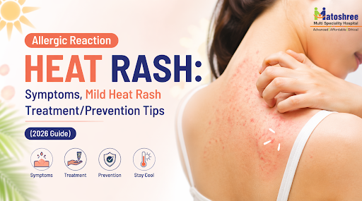 Allergic Reaction Heat Rash: Symptoms, Mild Heat Rash Treatment/Prevention Tips (2026 Guide)